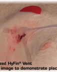 Supplies - Medical - Bandages - North American Rescue HyFin Vent Compact Chest Seal Twin Pack