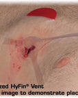 Supplies - Medical - Bandages - North American Rescue HyFin Vent Compact Chest Seal Twin Pack